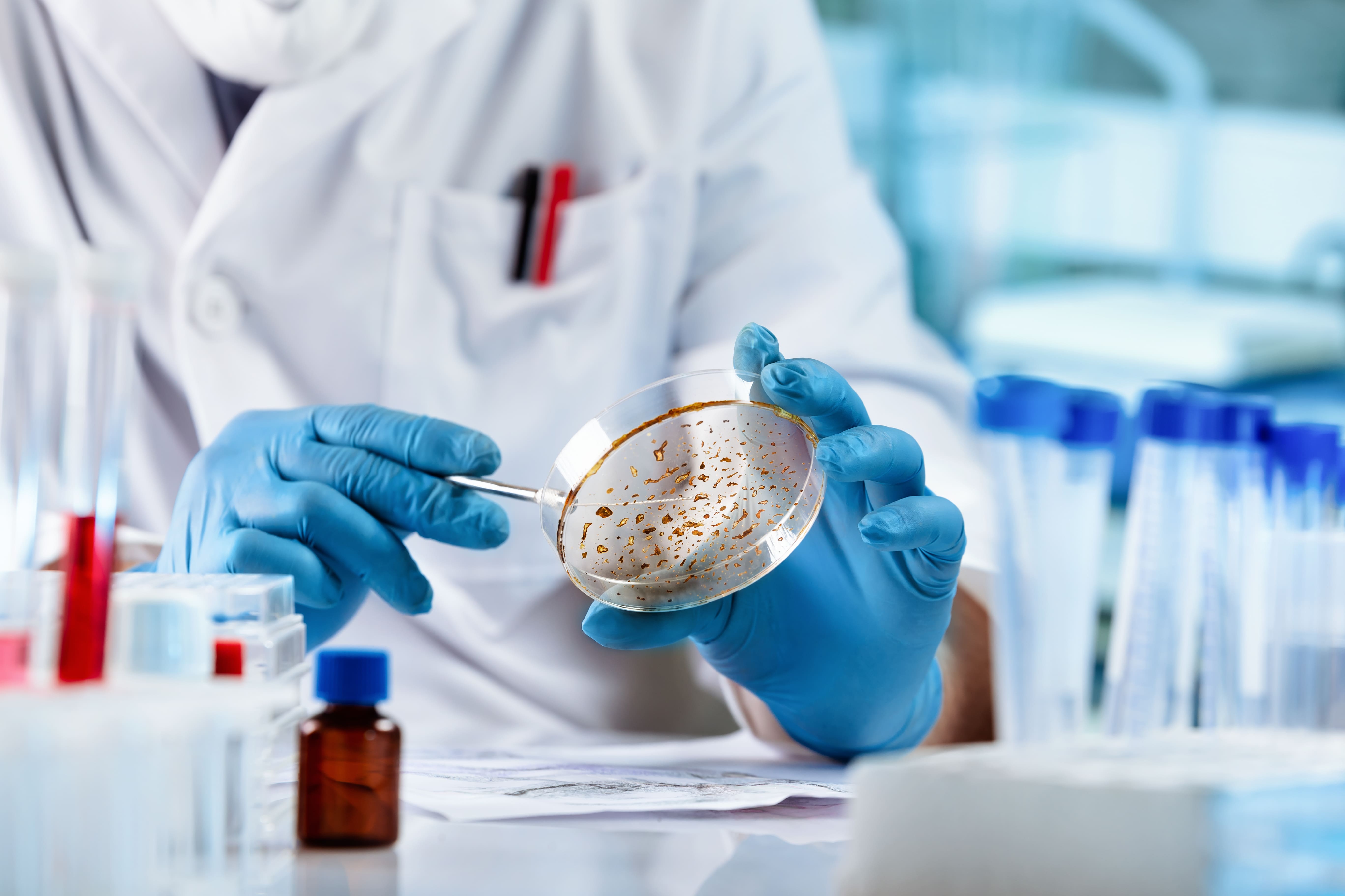 Microbial Contamination